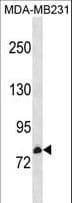 Polyclonal Rabbit anti-Human CNNM3 Antibody (aa431-457, WB)