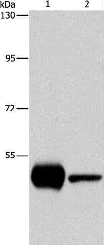 Polyclonal Rabbit anti-Human PIP4K2A / PIPK Antibody (IHC, WB)
