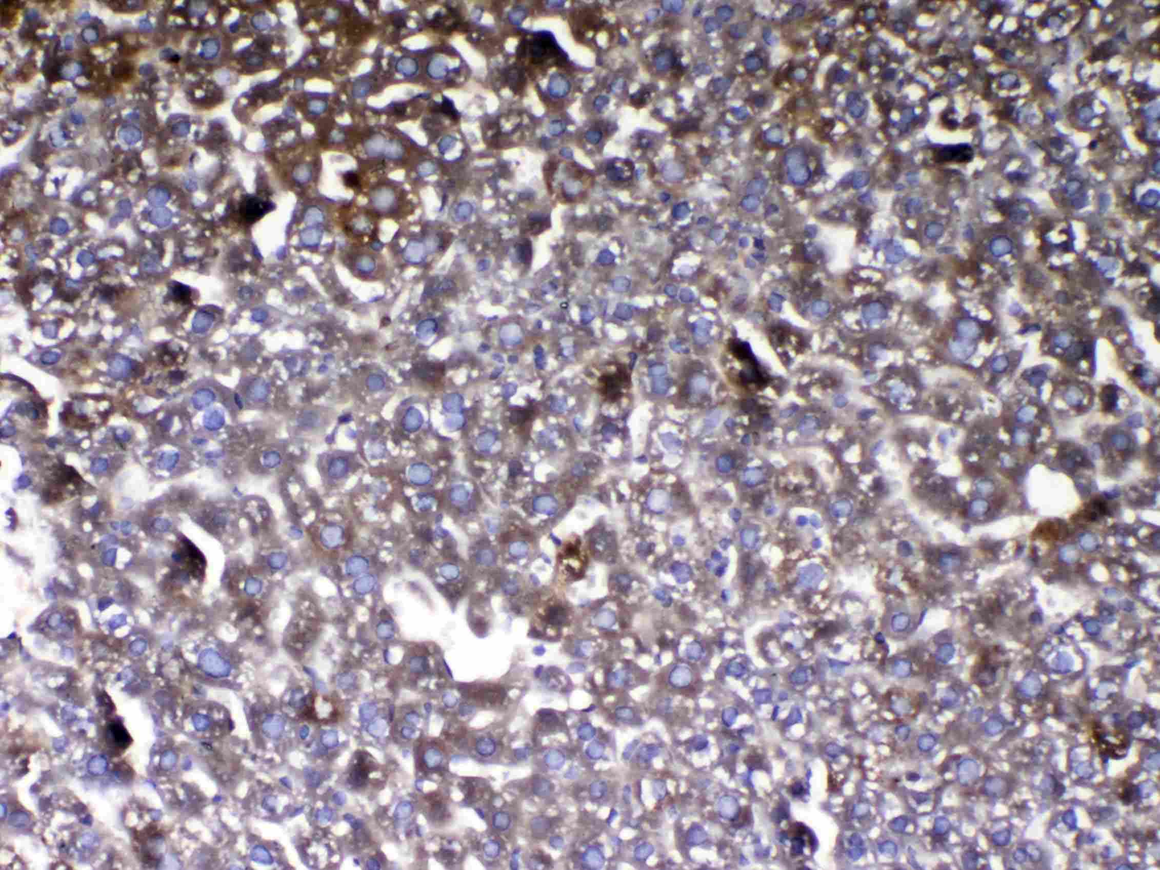 GC / Vitamin D-Binding Protein Antibody
