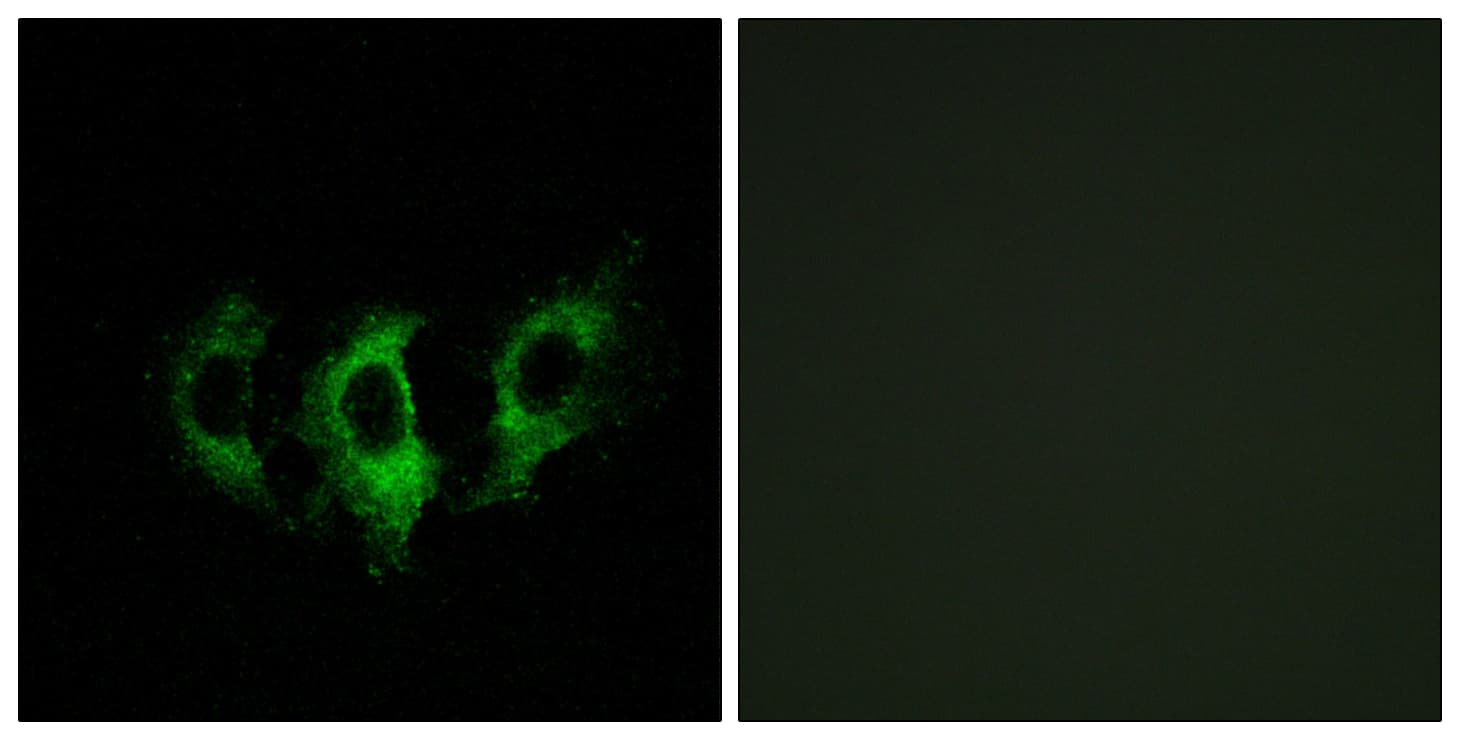 GFM2 Antibody (aa441-490)