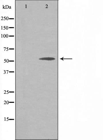 API5 Antibody