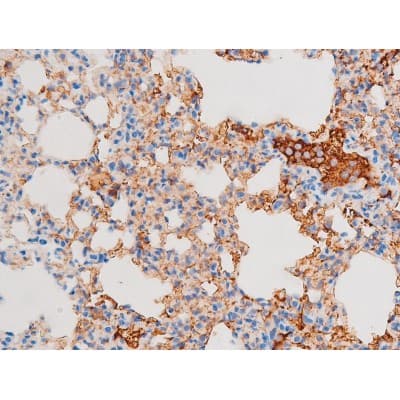 Polyclonal Rabbit anti-Human DNM1 / Dynamin Antibody (phospho-Ser774, IHC, WB)