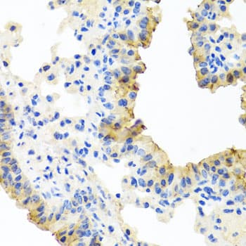 FECH / Ferrochelatase Antibody