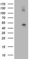 TUBB4 / Tubulin Beta 4 Antibody (clone 3C12, Carrier-free)