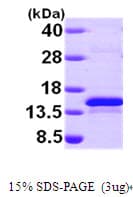 Human SEPX1 / Selenoprotein R (Recombinant His)