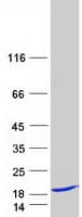 Human TAX1BP3 Protein (Recombinant Myc-DDK (Flag))