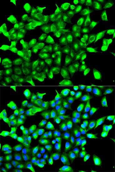 EGLN1 / PHD2 Antibody