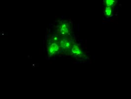 Monoclonal Mouse anti-Human NTRK3 / TRKC Antibody (clone OTI4E10, IHC, IF, WB)
