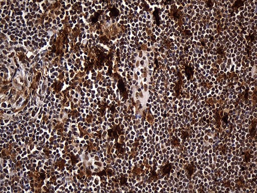 Monoclonal Mouse anti-Human RAD21 Antibody (clone OTI6C10, aa193-458, IHC, WB)