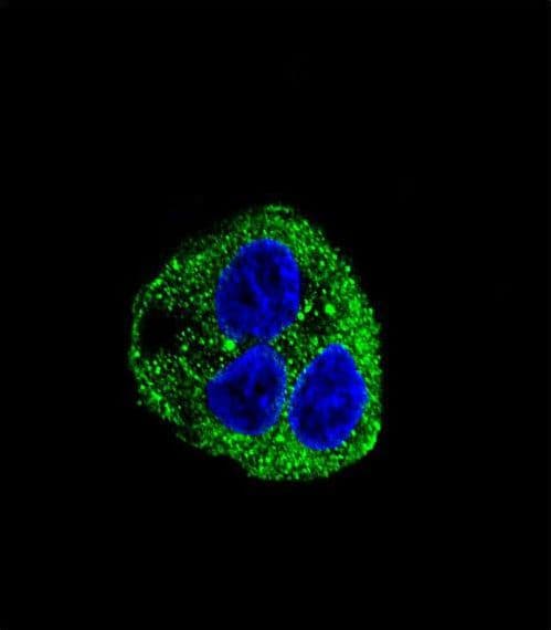 Leptin Antibody (aa134-166)