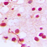 ZNF76 Antibody (Internal)