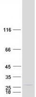 Human MRPL11 Protein (Recombinant Myc-DDK (Flag))