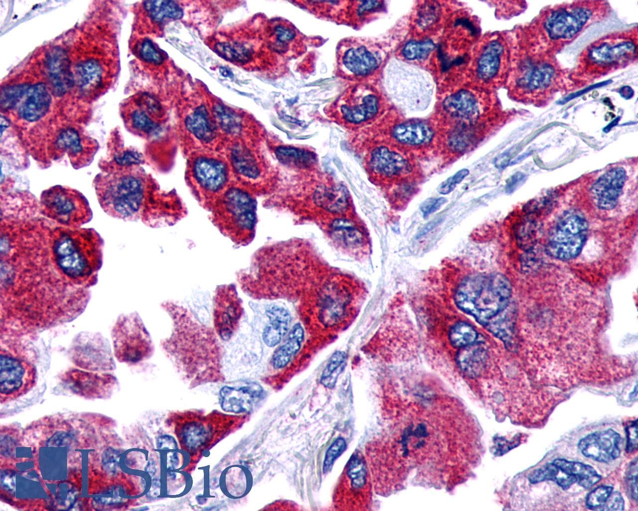 PathPlus™ Polyclonal Rabbit anti-Human PTGER4 / EP4 Antibody (C-Terminus, IHC)