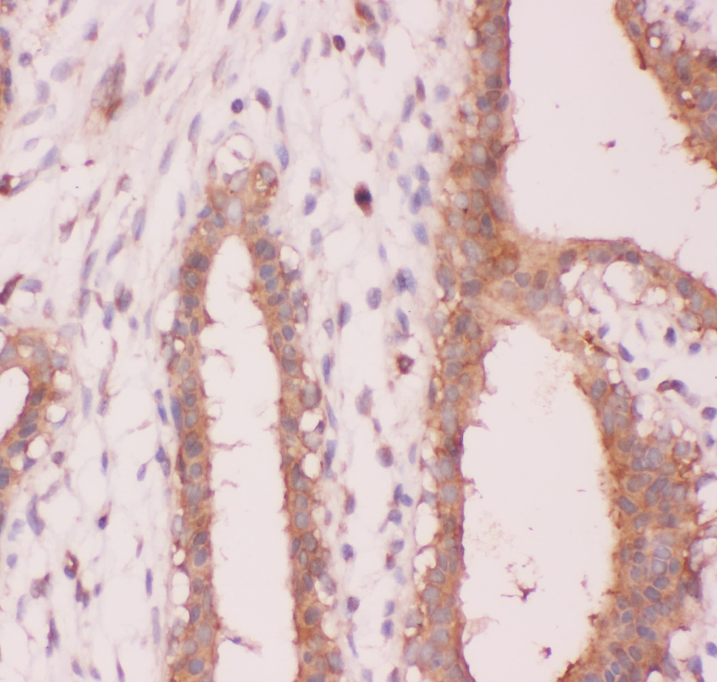 NFKB2 Antibody (aa1-340)
