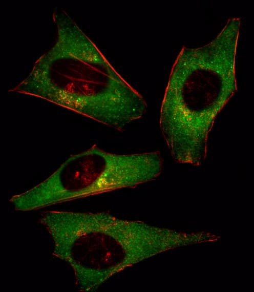 PIK3CD / PI3K Delta Antibody (aa85-114)