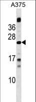 MBD3L1 Antibody (aa168-194)