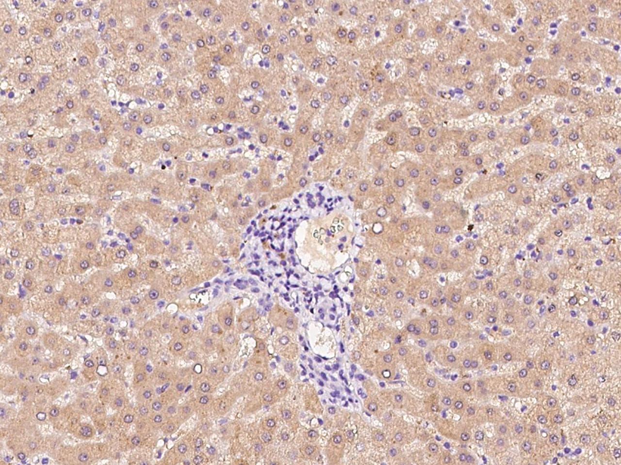 F12 / Factor XII Antibody (Preservative Free)