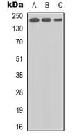 Polyclonal Rabbit anti-Human BRCA1 Antibody (C-Terminus, IHC, IF, WB)