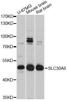 Polyclonal Rabbit anti-Human SLC30A6 Antibody (WB)
