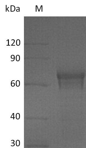 Human IL15RA Protein (Recombinant Fc, C-terminus)