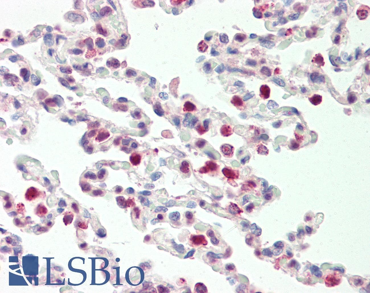 IHC-plus™ CKAP4 Antibody (aa574-602)