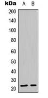 CLDN19 / Claudin 19 Antibody (Internal)