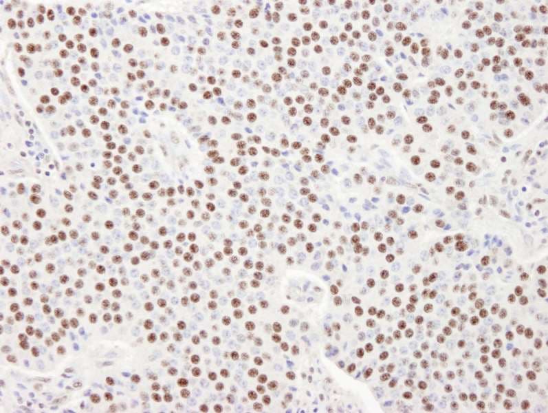 SART3 Antibody (aa600-650)