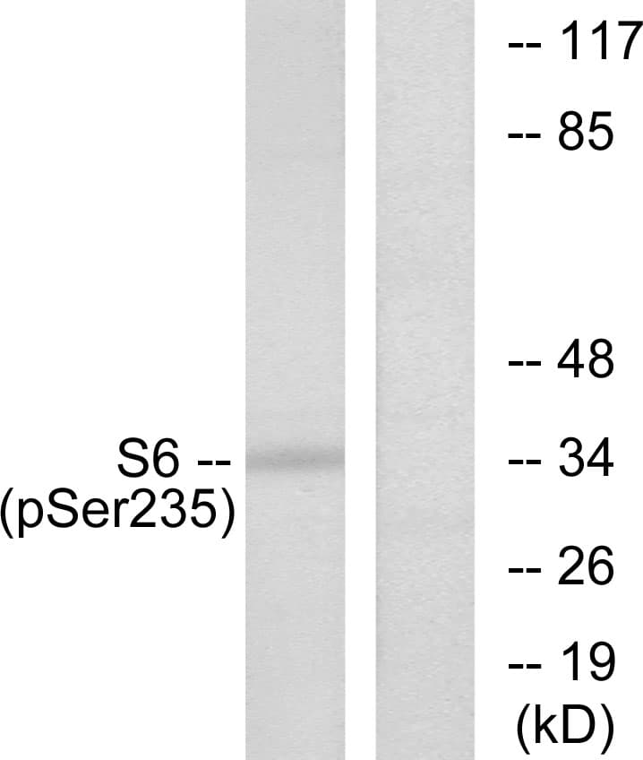 Polyclonal Rabbit anti-Human RPS6 / Ribosomal Protein S6 Antibody (phospho-Ser235, WB)