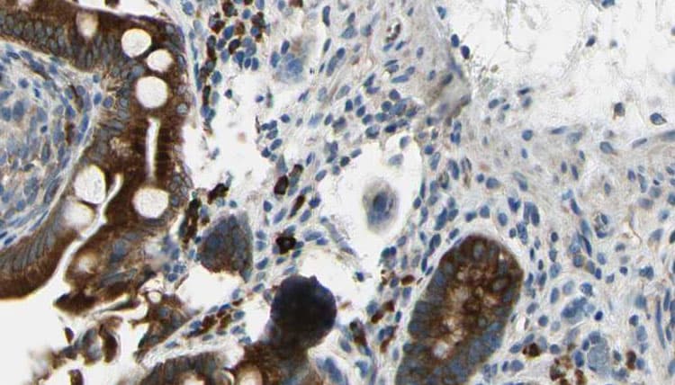 Polyclonal Rabbit anti-Human GABRB1 Antibody (IHC, IF, WB)