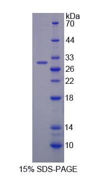 Human BTD / Biotinidase Protein (Recombinant His-S)