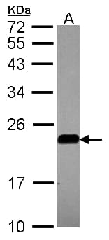 CAV2 / Caveolin 2 Antibody (aa1-45)