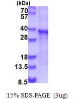 Human RASL12 Protein (Recombinant His)