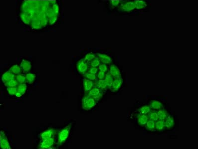 MXI1 / MAD2 Antibody
