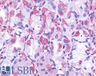 PathPlus™ Polyclonal Rabbit anti-Human CCKBR / Cckb Antibody (Cytoplasmic Domain, IHC)