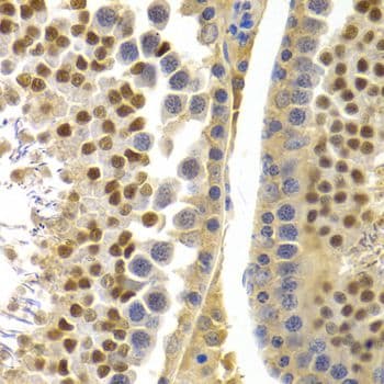 Polyclonal Rabbit anti-Human APOBEC3G / CEM15 Antibody (IHC, IF)