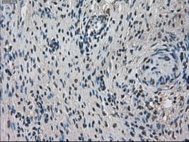 TMEM100 Antibody (clone OTI1F8)