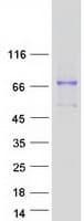 Human GALNT1 Protein (Recombinant Myc-DDK (Flag))