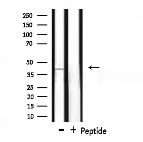 Polyclonal Rabbit anti-Human WNT7A Antibody (IHC, WB)