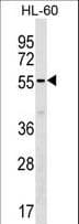 Polyclonal Rabbit anti-Human SAMM50 Antibody (aa163-189, WB)