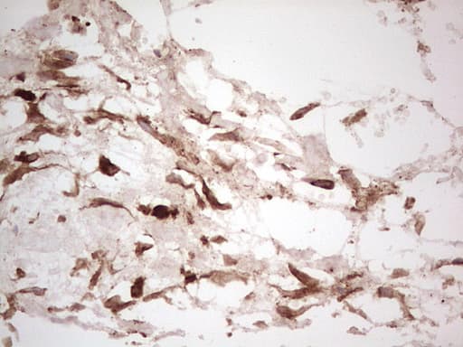 LGALS9 / Galectin 9 Antibody (clone OTI1D12)