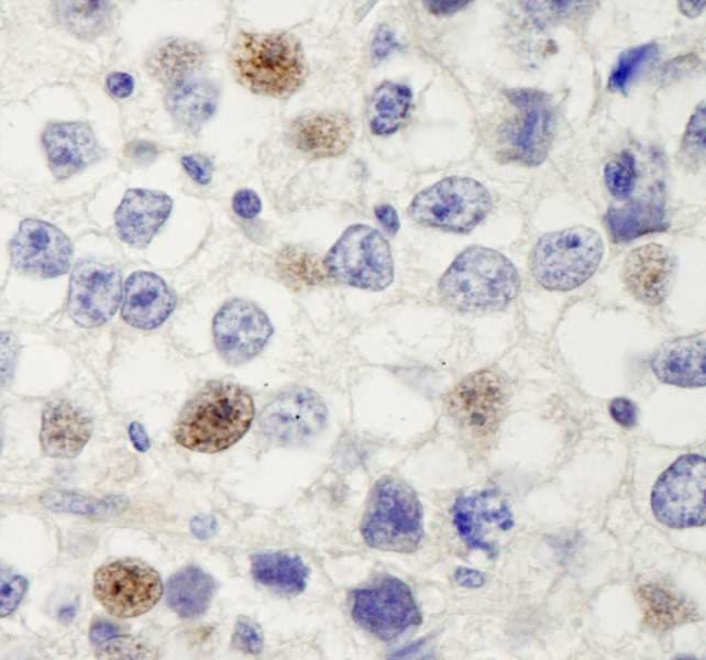 HURP / DLGAP5 Antibody (aa200-250)