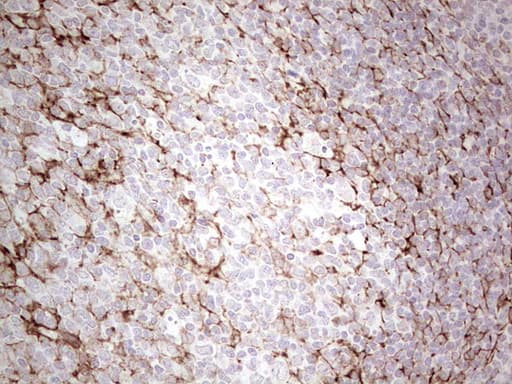 DMN / Desmuslin / Synemin Antibody (aa329-580, clone OTI3D10)