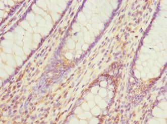 Polyclonal Rabbit anti-Human PDCD5 Antibody (IHC)