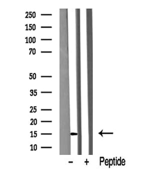 VAMP4 / VAMP-4 Antibody