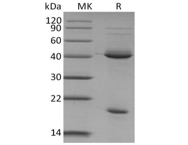 Mouse IL23A / IL-23 p19 Protein (Recombinant)