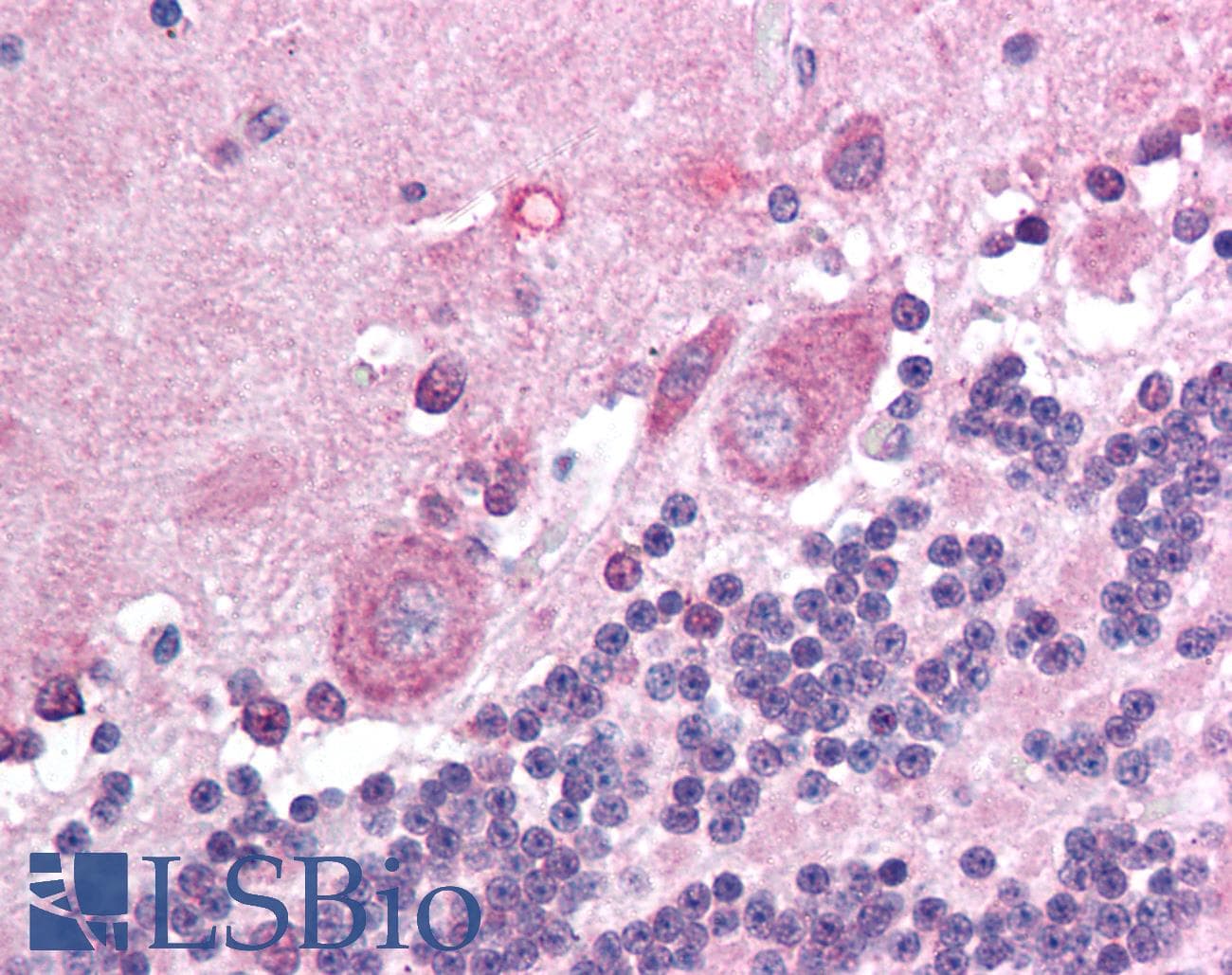 IHC-plus™ HEC1 / NDC80 Antibody (aa56-642, clone 9G3.23)