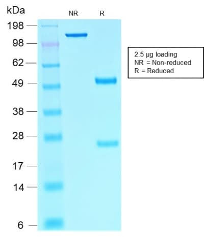 Recombinant Monoclonal Mouse anti-Human SOX10 Antibody (clone rSOX10/1074, Azide-free,Carrier-free, aa115-269, IHC)