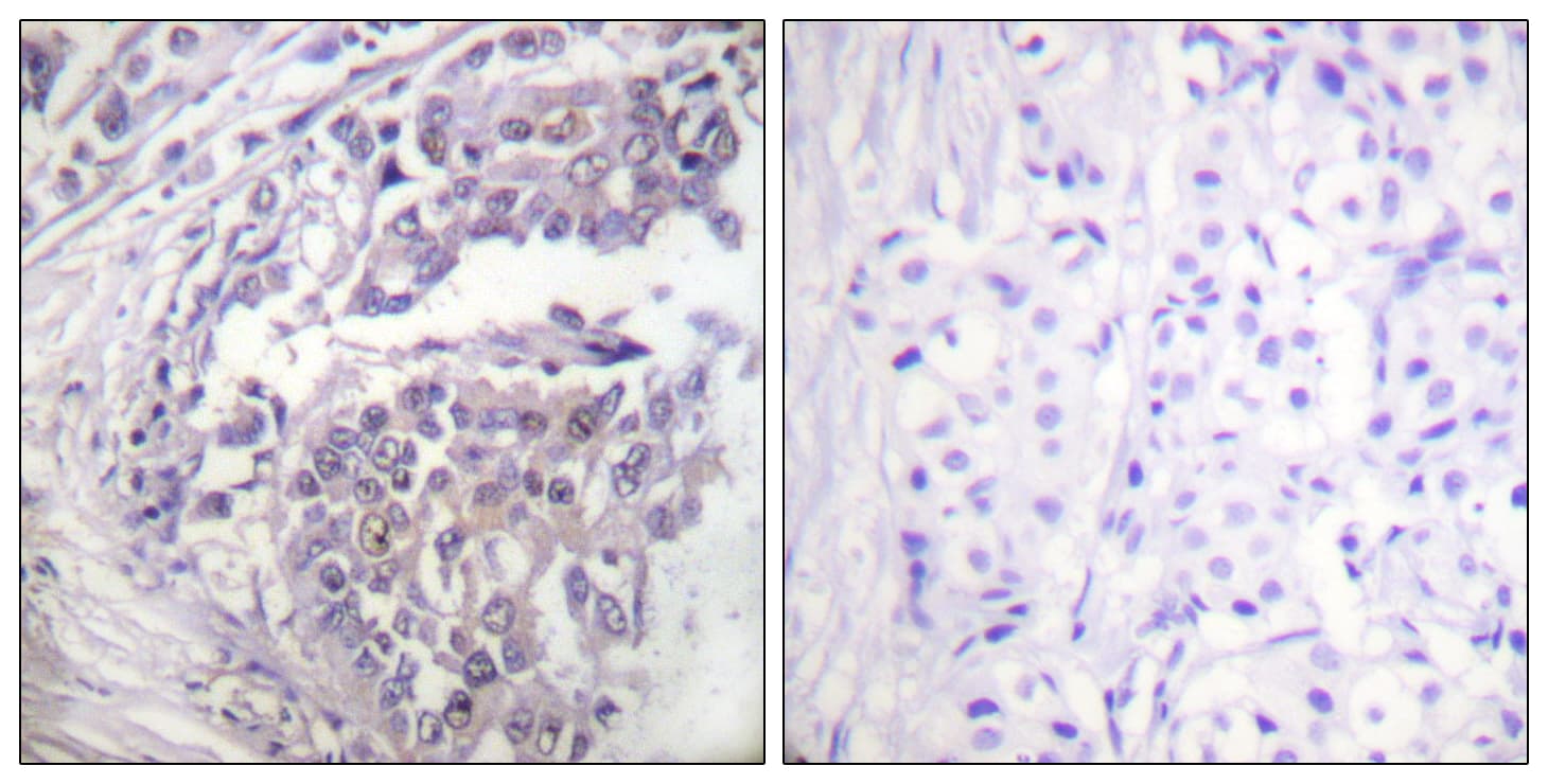 Histone H2B Antibody (Acetyl-Lys5)