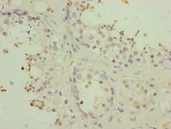 PMPCB / MPP11 Antibody