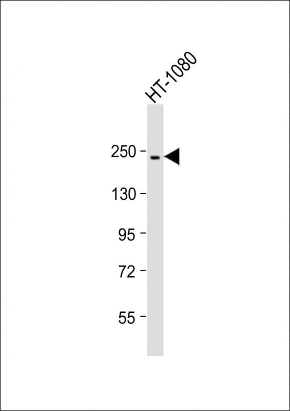 PBRM1 / BAF180 / PB1 Antibody (clone 1636CT387.122.52)